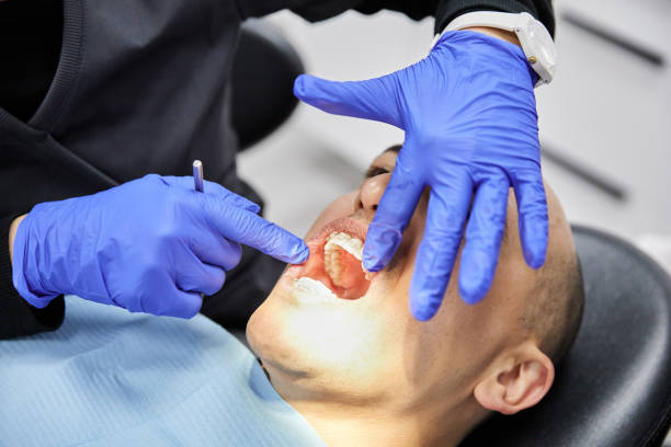 Best Emergency Dental Care for Abscessed Tooth in Fulton, MS