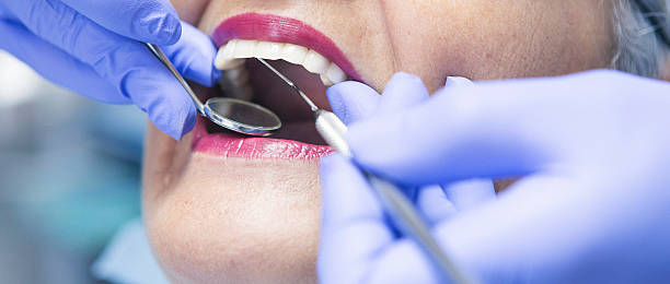 Best Emergency Dental Services for Seniors in Fulton, MS